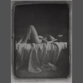 Anatomia melancholii [2]