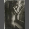 Anatomia melancholii [15]